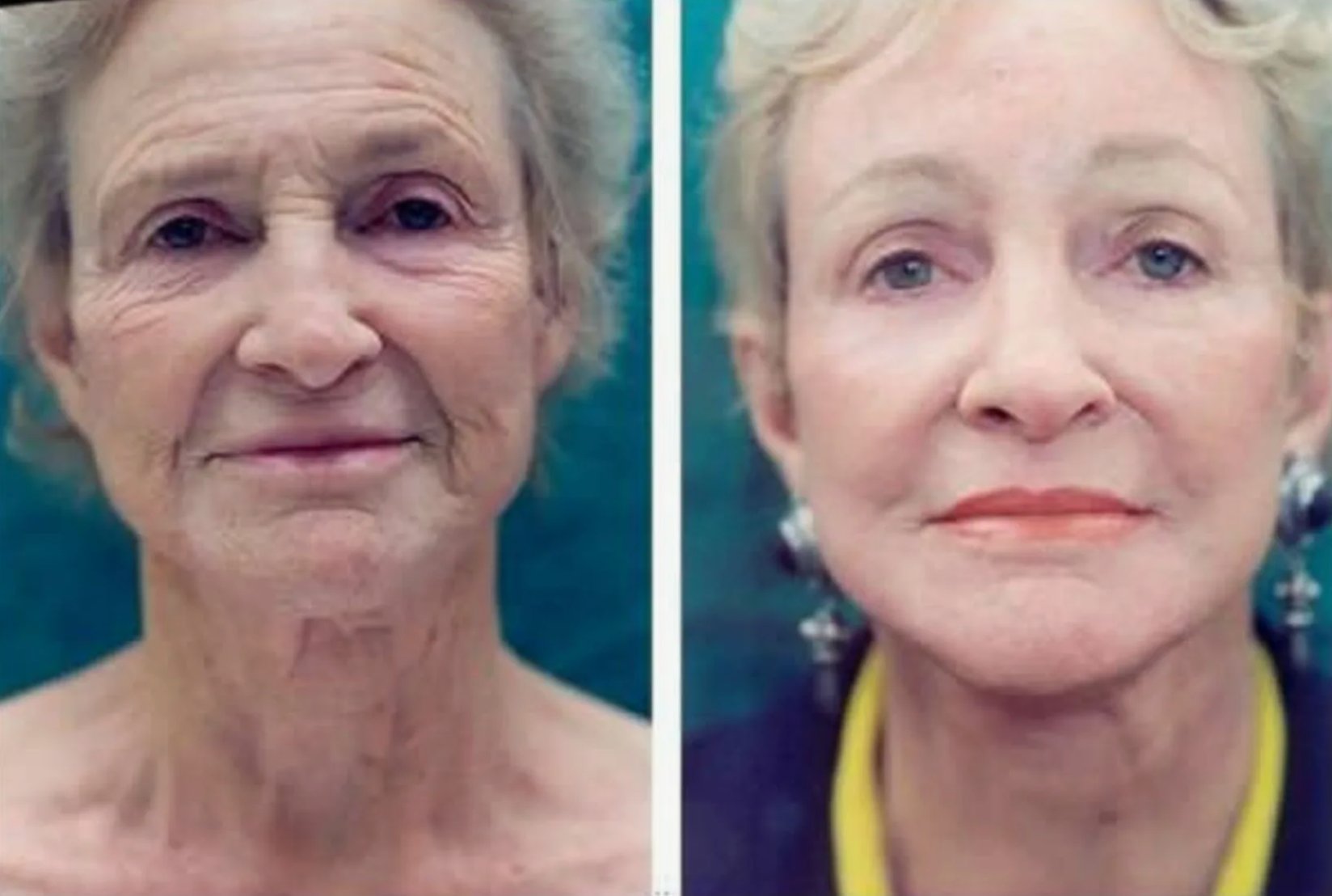 До и после — результат 3