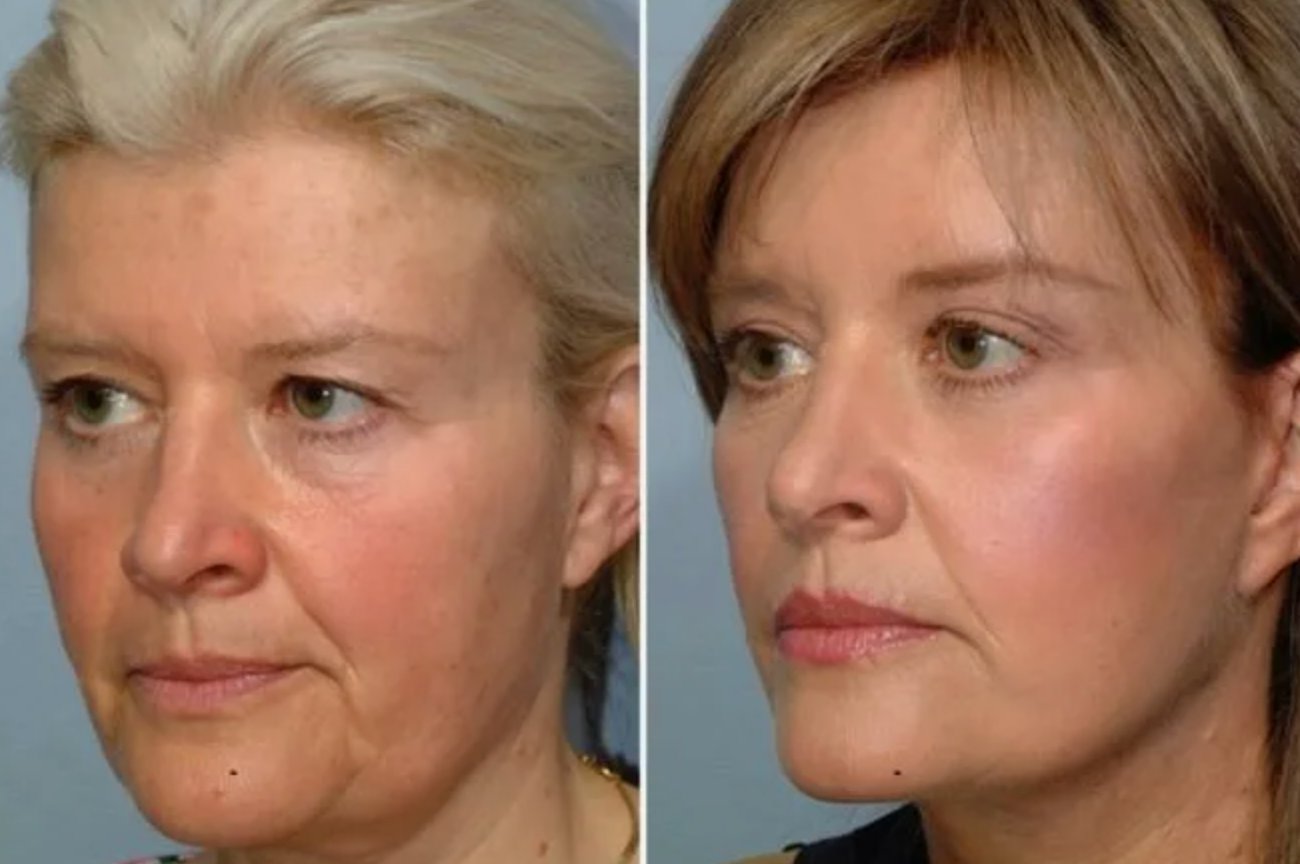 До и после 6